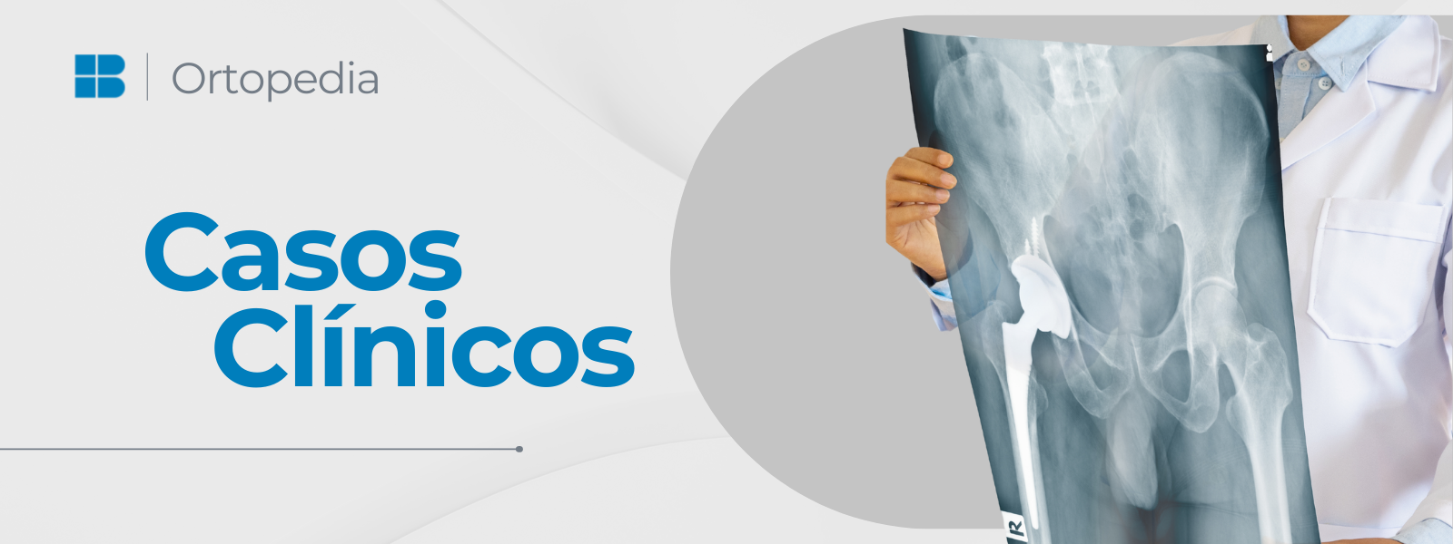 Banner - Baumer Ortopedia: Casos Clínicos/Congresso Brasileiro de Quadril